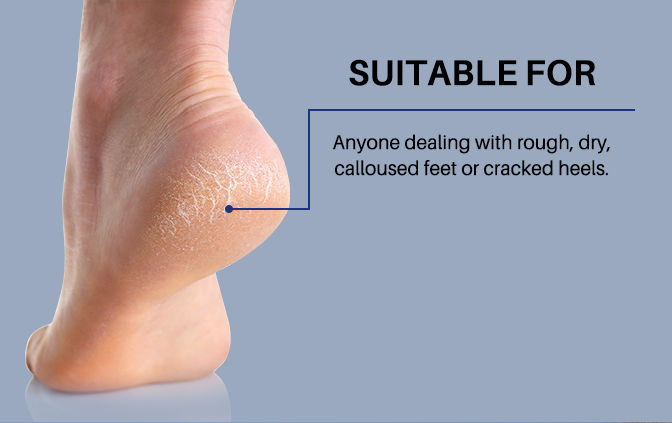 DermDoc 15% Glycolic Acid & 4% Lactic Acid InstaPedi Foot Peeling Mask – 40 ml