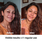 DERMDOC 10% Vitamin C Face Serum Glow Pods (Pack of 20 * 0.5 ml Each) (10 ml) | Potent Face Serum Sachets | Travel-Friendly | Brightening | Fights Dark Spots, Pigmentation & Dull Skin | Serum For Acne