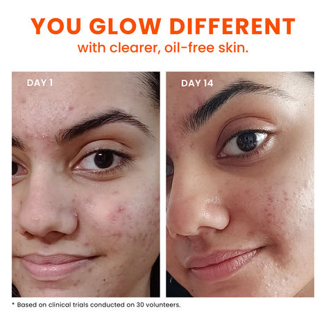 Foxtale Deleted Items Niacinamide Clarifying Serum – 30 ml