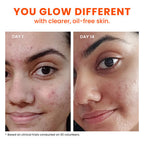 Foxtale Deleted Items Niacinamide Clarifying Serum – 30 ml